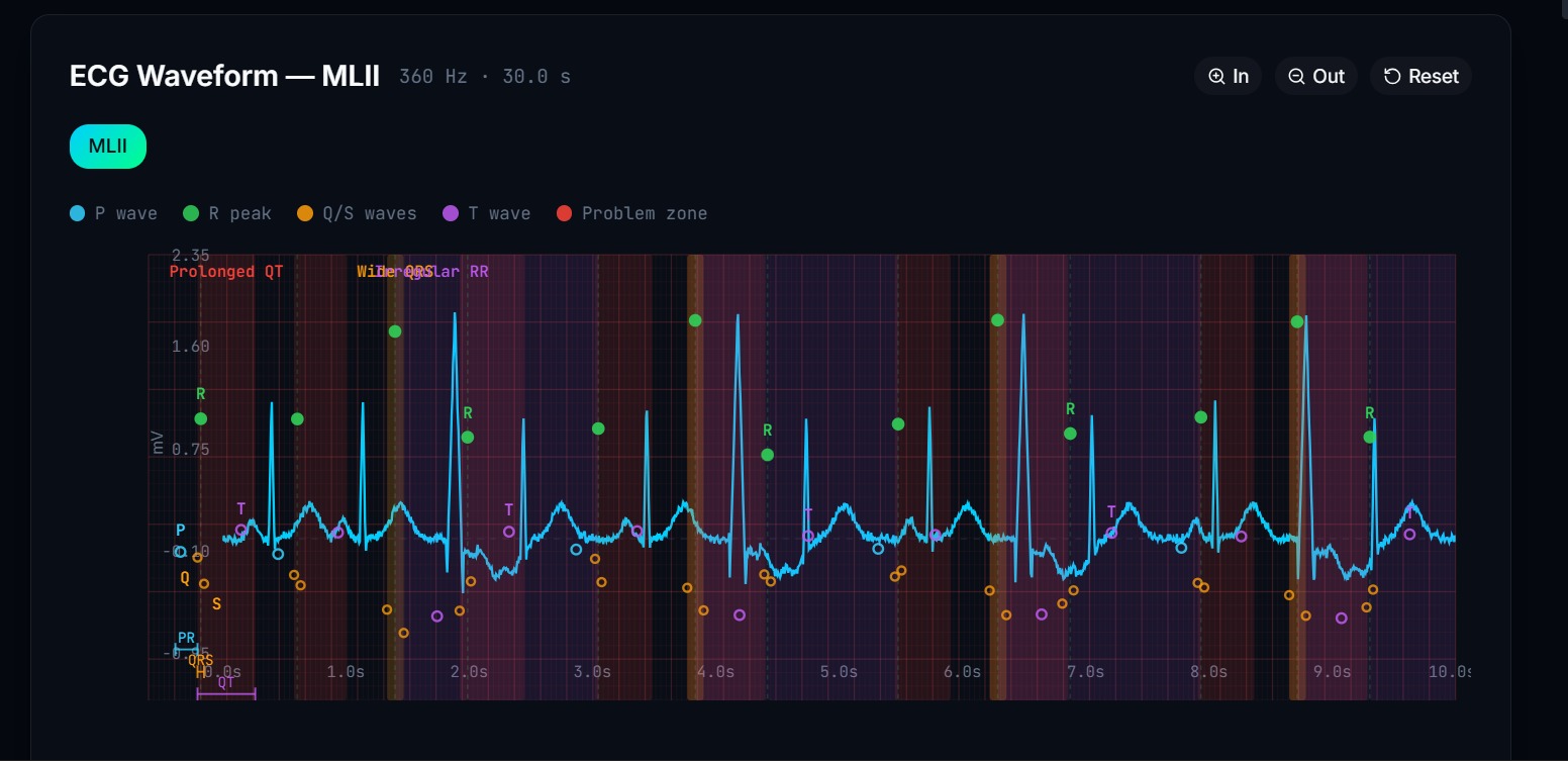 MedQuantum-NIN · ECG waveform annotation
